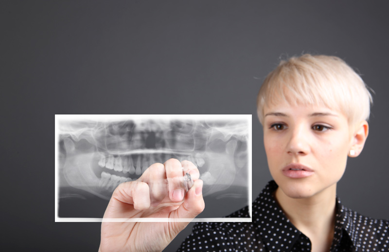 Cirugia Maxilofacial